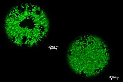 緑色に蛍光する2つの円形の構造が写った顕微鏡画像